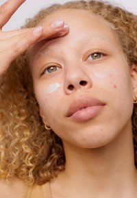 Gros plan sur une personne appliquant de la crème sur son visage ; peau claire, cheveux blonds ondulés, acné visible, couleur naturelle subtile des lèvres, boucles d'oreilles en or.