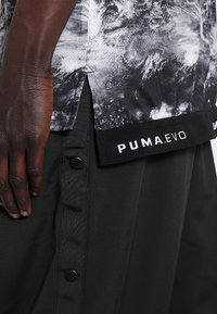 Mörkhyad hand som vilar bredvid svarta byxor med tryckknappar och en svart-vit PUMA EVO-tröja med en slits på sidan.