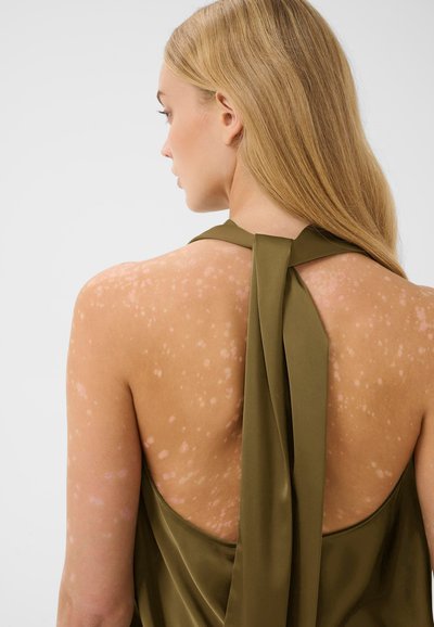 Femme aux longs cheveux blonds portant un top dos nu vert olive montrant des taches de peau plus claires sur son dos et ses épaules.