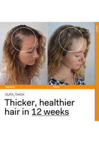 The Nue Co. SUPA_THICK HAIR LOSS SCALP SERUM - Haarverzorging