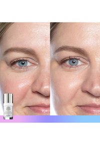 En serumflaske mærket "Good Genes" vises ved siden af før-og-efter nærbilleder af huden omkring øjnene, der viser en mere glat tekstur.