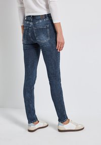 Jeans skinny en denim bleu foncé avec une taille haute, dotés de poches arrière et d'une texture décolorée ; associés à des baskets blanches et beiges.