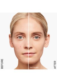 Vergelijking voor en na van de huid; de linkerkant toont oneffenheden, de rechterkant lijkt glad en gelijkmatig van toon. Schaduw gemarkeerd als 240 Quartz.