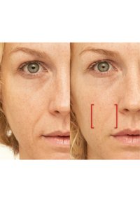 Comparaison faciale montrant deux visages similaires. Côté gauche : teint naturel, légères rides ; côté droit : peau plus lisse avec des cases rouges mettant en évidence des zones.