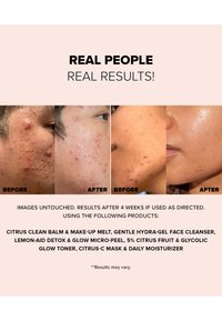 NUDESTIX NUDESKIN 3-STEP CITRUS SKIN RENEWAL - MAKEUP (MELT, MICRO-PEEL, MOISTURIZER) - Ansiktsvårdsset