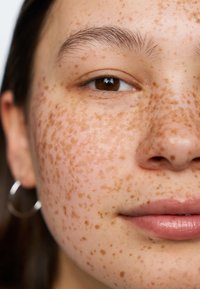 Nærbilde av et ansikt med lys hudtone, mange brune fregner og naturlige lepper. Liten sølv ringøredobb synlig. Klar hudstruktur.