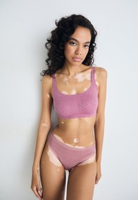 Kvinne med vitiligo som har på seg en mauve-mønstret bralette og matchende truser, stående mot en lys ensfarget bakgrunn med krøllete hår.