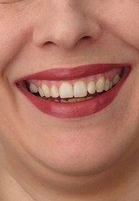 Miniatyrbilde 5