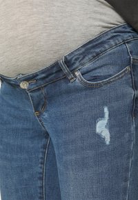 Los jeans de denim azul oscuro presentan un corte ajustado con un sutil parche desgastado en el muslo superior y un clásico cierre de botón en la cintura.