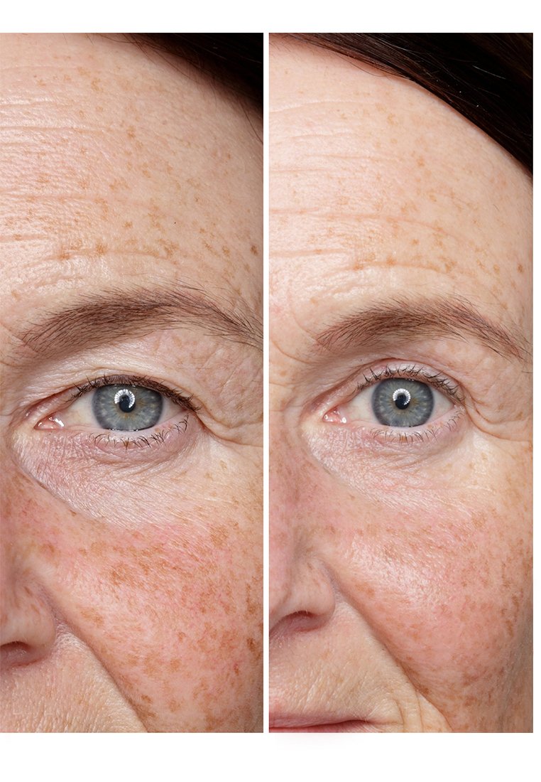 babor hsr lifting serum