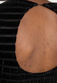 Schwarzes Kleid mit vertikalen Samtstreifen, einem markanten offenen Rückendesign und glatter, darunter sichtbarer Haut.