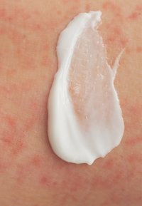 White cream smudge on light skin, slightly glossy texture, with a smooth application. Skin shows faint reddish spots surrounding the cream.