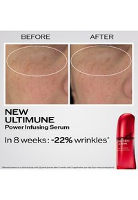 Gros plan sur la peau du visage montrant la réduction des rides dans la zone cerclée après 8 semaines d'utilisation du Sérum Puissance Infusante Ultimune, avec le flacon du produit visible.