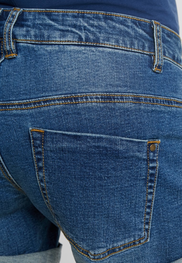 Damen Kleider | Forever Fit TURN UP Jeans Shorts blue/blau - MH59339 Damen Kleider | Forever Fit TURN UP Jeans Shorts blue/blau - MH59339
