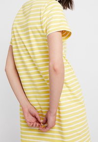 Henkilö kelta- ja valkoraitaisessa lyhythiisessa mekossa, kädet ristissä selän takana, kääntynyt pois kamerasta.