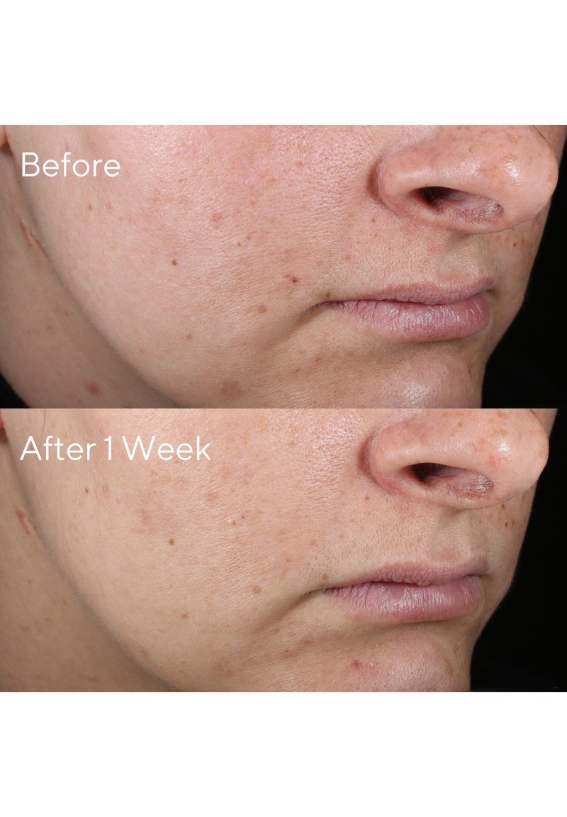 Murad Rapid Age Spot Correcting Serum Serum Zalando De
