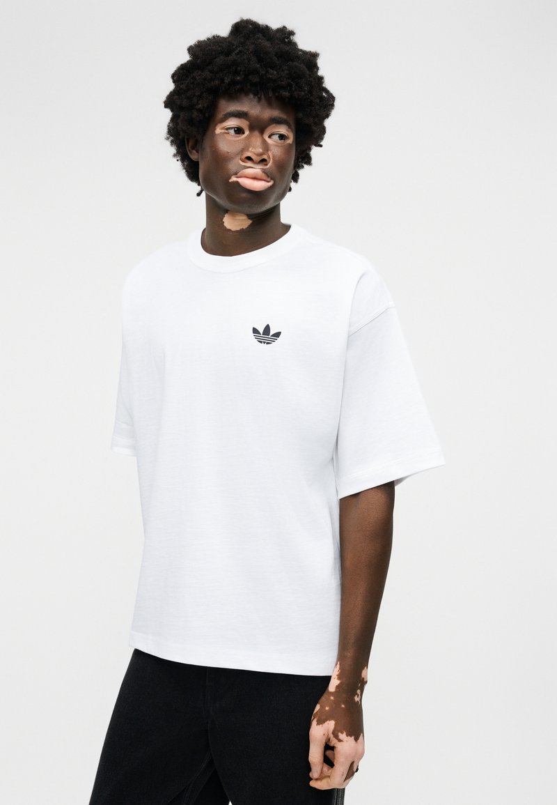 Junge Person mit Vitiligo, die ein weißes Adidas-T-Shirt und schwarze Hosen trägt, vor einem schlichten hellen Hintergrund stehend und zur Seite blickend.