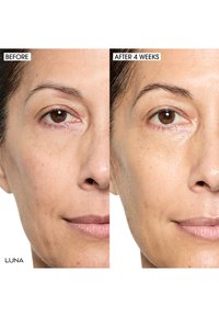 Deux portraits côte à côte montrant la peau faciale avant traitement et après 4 semaines. À gauche : texture sèche et légèrement inégale. À droite : peau plus lisse et plus radieuse.