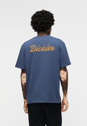 Άτομο με λεύκη στα χέρια που φοράει μπλε μπλουζάκι Dickies, στέκεται με την πλάτη προς τη φωτογραφική μηχανή σε απλό φωτεινό φόντο.