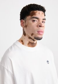 Camiseta blanca de algodón con un logotipo circular en el pecho. El sujeto tiene el cabello rizado y corto, y se pueden ver patrones en la piel en el cuello y la cara.