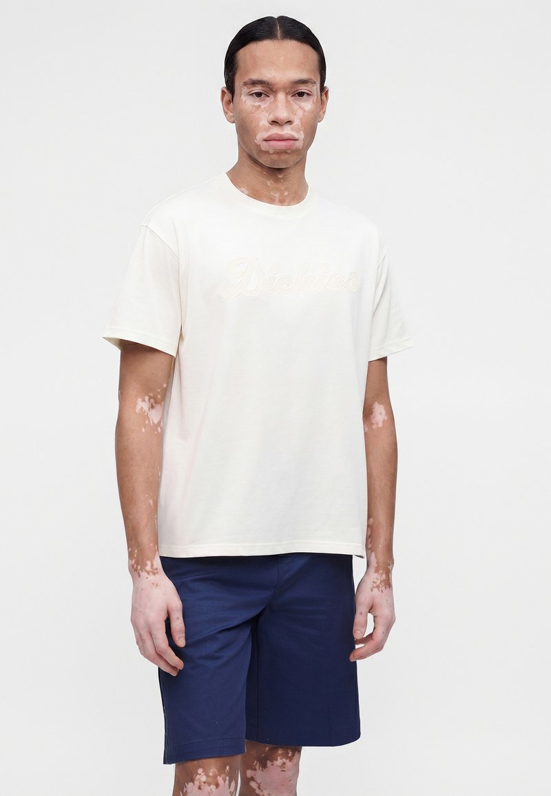 Mann mit Vitiligo, trägt ein weißes Dickies-T-Shirt und marineblaue Shorts, steht vor einem einfarbigen hellen Hintergrund.