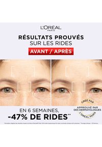 Images avant et après de L'Oréal Paris montrant la peau autour des yeux ; réduction visible des rides, avec un texte mettant en avant les résultats.