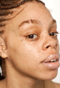 Närbild av ett ansikte med flätat hår. Framträdande fräknar över huden, jämn textur, bruna ögon och naturlig läppfärg.