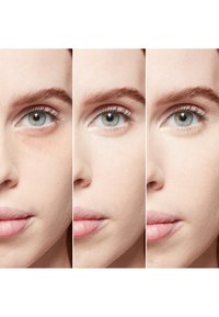 Miniatuurafbeelding 2