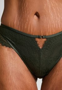 Närbild av en persons midja som visar brun hud med bristningar och mörkgröna spetsunderkläder med en liten framklippning och metallring.