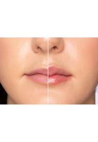 Voor en na afbeeldingen van lippen; de ene kant heeft een matte afwerking, de andere is glanzend met een gladde textuur en een natuurlijke roze teint.