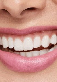 Primo piano di una bocca sorridente con denti bianchi e luminosi. Rossetto rosa chiaro esalta le labbra piene. Texture liscia e design pulito.