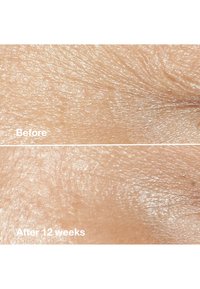 Clinique SMART CLINICAL REPAIR WRINKLE CORRECTING CREAM - Dagkrem