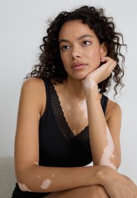 Black tank top featuring a lace trim along the neckline, with a smooth texture. Model has a contemplative pose, showing skin with light patches.