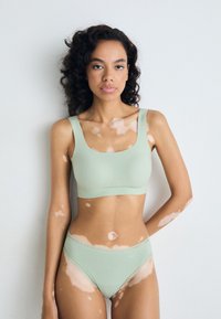 Kvinna med vitiligo iklädd ljusgrön bh och trosor, stående framför en enkel vit bakgrund, vänd mot kameran med neutral uttryck.