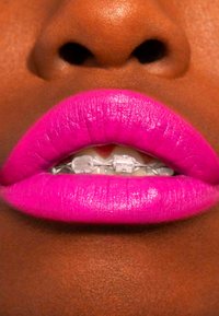 Klare, glitrende rosa lepper med blank finish, som avdekker tydelige tannreguleringssystemer, mot mørk hud. Glatt tekstur og veldefinert form forbedrer synligheten.