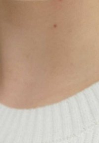 Primo piano di un'area del collo beige chiaro parzialmente visibile sopra un maglione bianco a coste, che mostra una consistenza della pelle liscia e piccole imperfezioni.