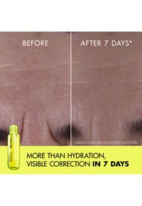 Primer plano de la frente que muestra líneas finas reducidas y piel más suave después de 7 días usando el Gel Electrolyte Dewy de Biotherm Aquasource+.