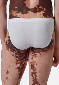 Slips en coton blanc portés par une personne avec un motif de peau marbrée marron sur les cuisses, mettant en valeur une texture lisse et un design ajusté.