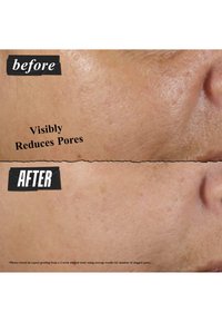 Före-och-efterjämförelse av hudens textur, som visar en synlig minskning av porerna. Den övre sektionen har större, mer påtagliga porer; den nedre är jämnare.