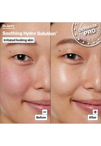 Comparaison avant-après montrant la peau du visage. Le côté gauche présente des rougeurs, tandis que le côté droit apparaît hydraté avec une texture lisse et brillante.