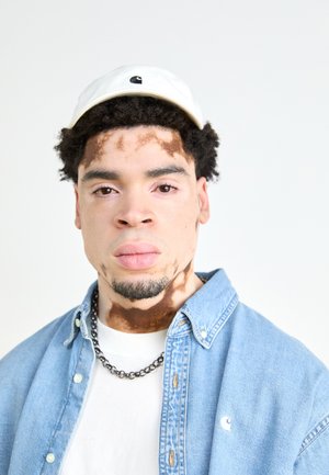 Baseball cap with a small logo, denim shirt, white t-shirt underneath, and a chain necklace; visible skin pattern variation on face.