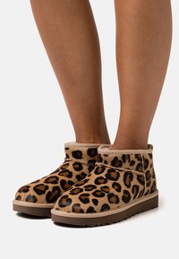 Botas de tobillo de estampado de leopardo en tonos marrón y negro, con una textura suave y puntera redondeada, un cuello beige y suela de goma para mayor tracción.
