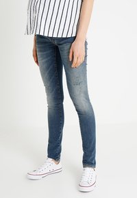 Jeans ajustados azules con ligero desgaste y parches descoloridos, hechos de denim. Combinados con zapatillas blancas y una camisa a rayas.