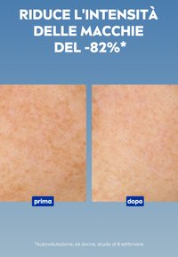 Primo piano della pelle che confronta due sezioni: a sinistra ci sono macchie più scure, mentre a destra è più liscia e ha meno imperfezioni visibili. Il testo qui sotto indica i risultati.