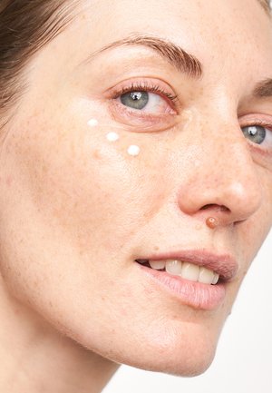 Produit de soin appliqué sous l'œil, crème blanche sur une peau tachetée de taches de rousseur brun clair, avec un arrière-plan neutre ; texture lisse visible.