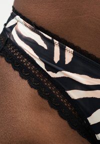 Κοντινό πλάνο μαύρου και λευκού εσωρούχου με σχέδιο ζέβρας και μαύρη δαντέλα, φορεμένο σε σκούρο δέρμα.