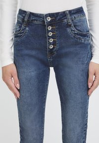 Sötétkék farmernadrág magas derékrésszel, öt gombos sliccel, zsebekkel és kontrasztos varrással. Sima textúra és testhez álló szabás.