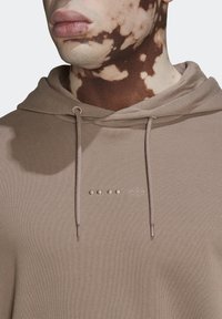 Närbild på en person med vitiligo som bär en beige huvtröja med dragsnören och en liten broderad logotyp på bröstet.