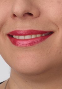 Miniatyrbild 5