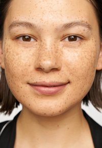 Close-up of a face with a smooth complexion and prominent brown freckles, almond-shaped brown eyes, and natural lips. Hair is dark and straight.